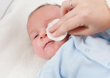 A conjuntivite neonatal (CN) é uma infecção ocular que acomete a conjuntiva de bebês no prazo de 24 horas até um mês após o nascimento.